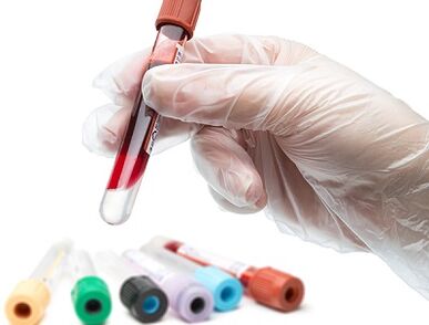 Esame del sangue per i parassiti
