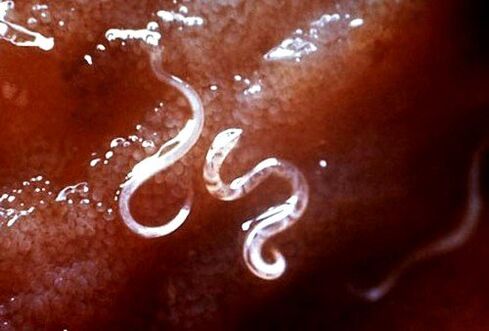 parassiti all'interno del corpo