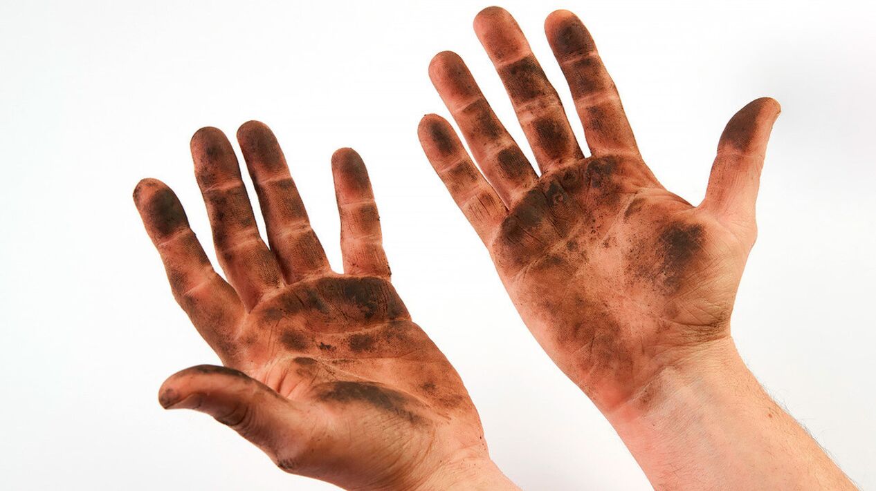 Coloro che abusano delle norme igieniche e non si lavano le mani corrono il rischio di contrarre i vermi