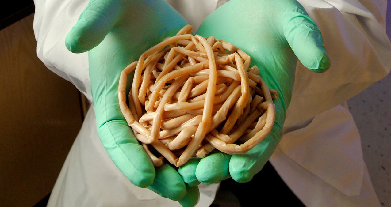 Vermi (elminti) nelle mani di un medico