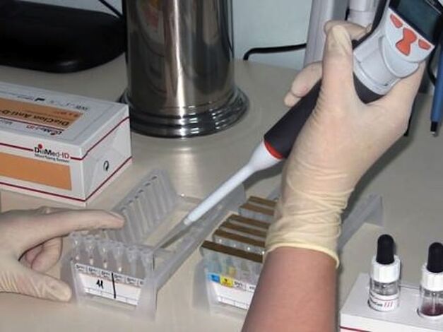 Esami di laboratorio per diagnosticare le malattie parassitarie
